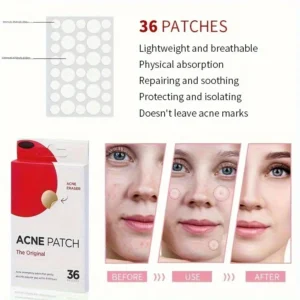 Acne Patch Hydrocolloid (36 pack)